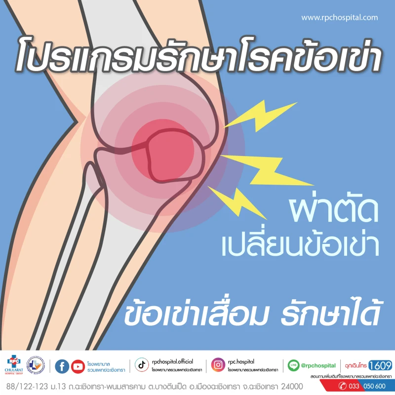 ผ่าตัดเปลี่ยนข้อเข่า