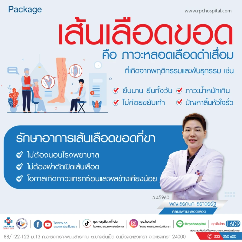 Package รักษาอาการเส้นเลือดขอด