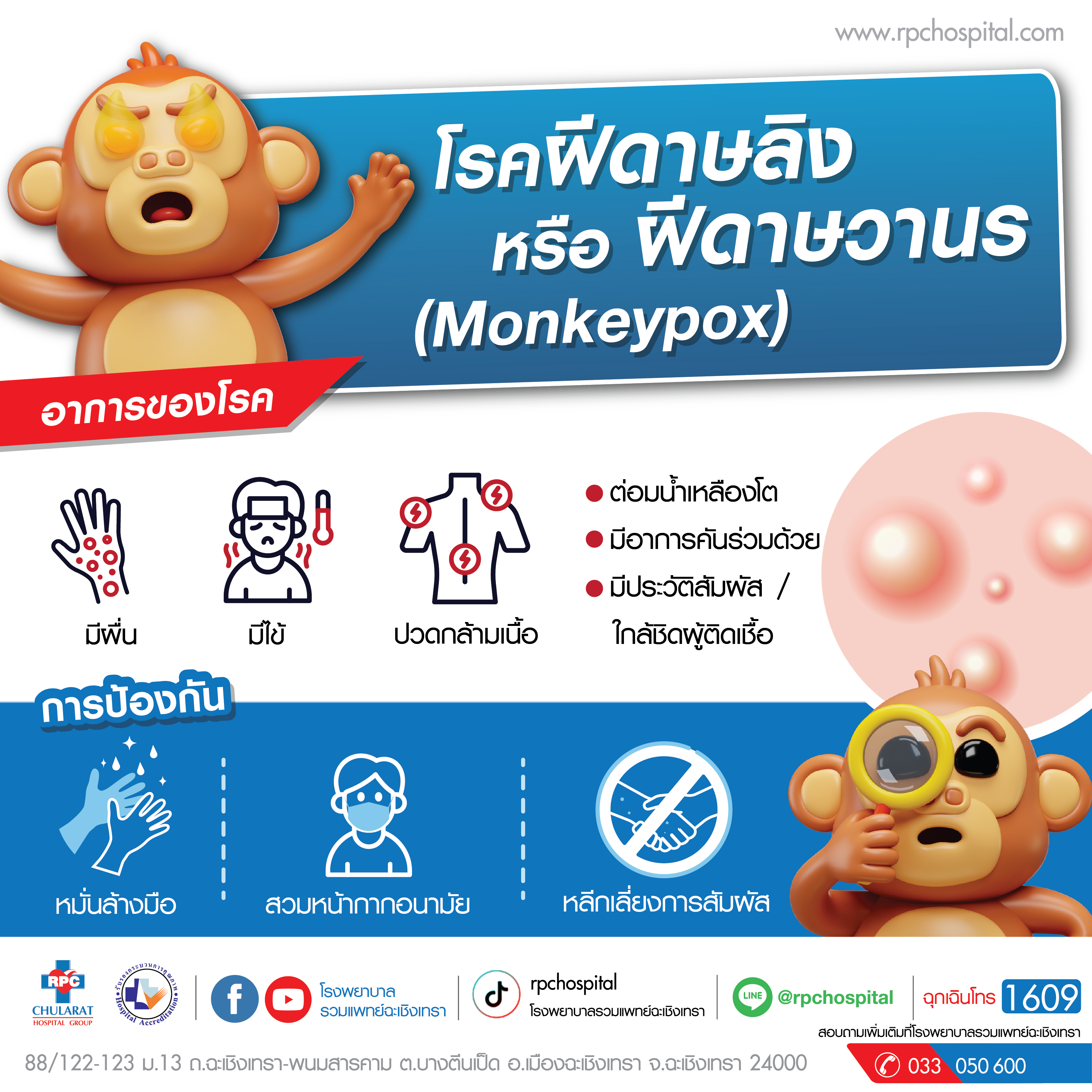 โรคฝีดาษลิง หรือฝีดาษวาวร (Monkeypox) - ความรู้สุขภาพ - โรงพยาบาลรวมแพทย์ฉะเชิงเทรา